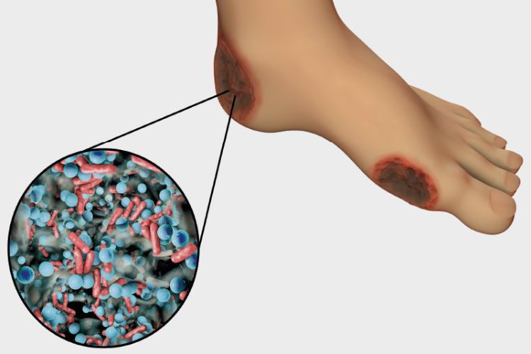 Corals, wound infection detection, and theoretical physics